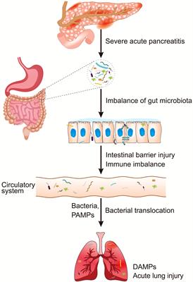 Intestinal Microbiota - An Unmissable Bridge to Severe Acute Pancreatitis-Associated Acute Lung Injury